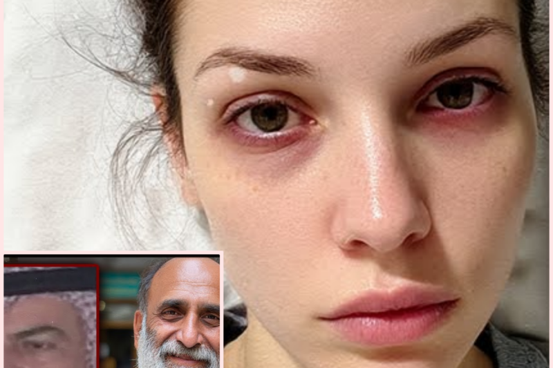 Ukrainian Model invited to Dubai Woke Up without a Kidney on a Sheikh’s Operating Table